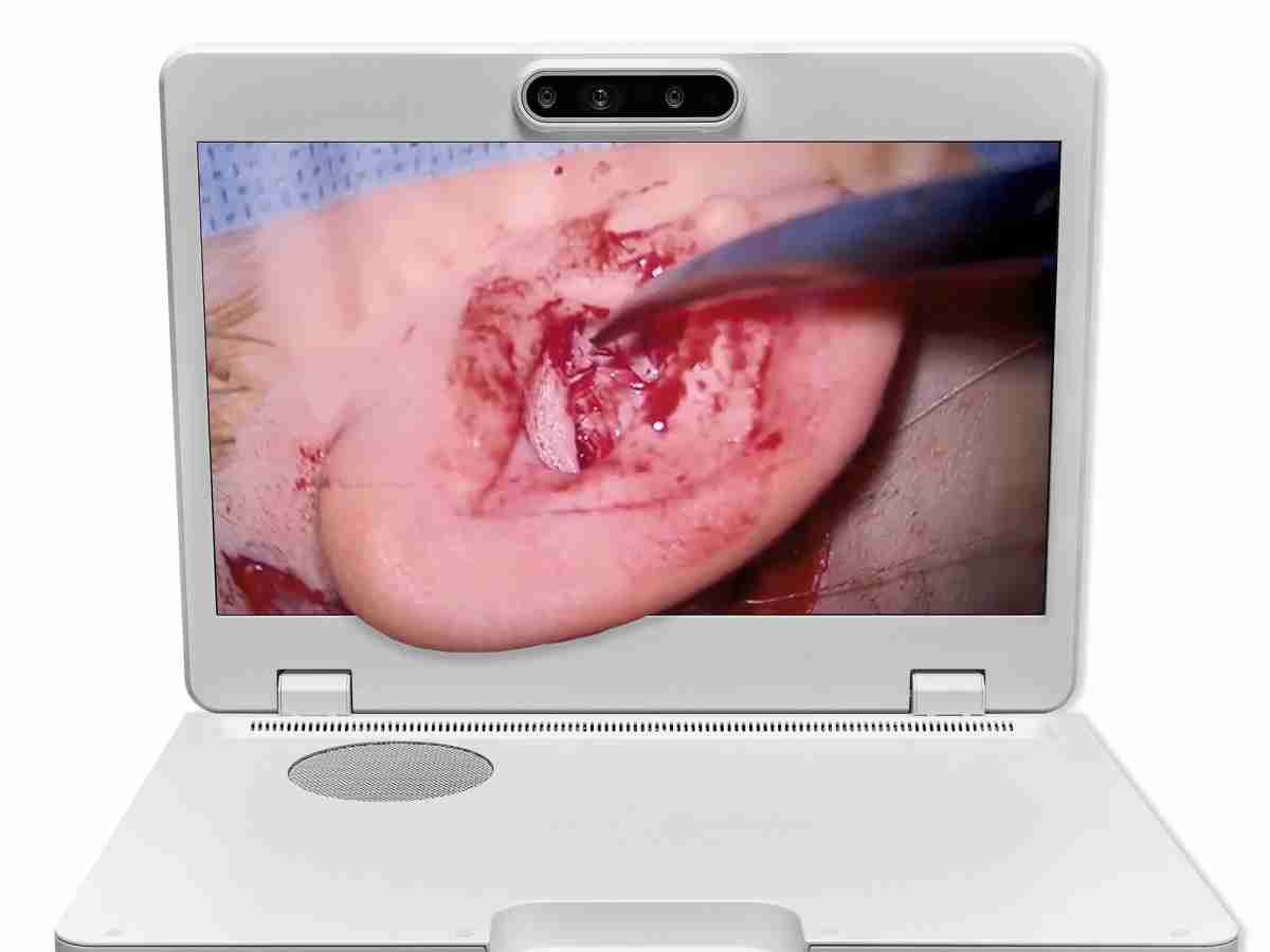 达擎之＂Heads-up 3D显微手术显示系统＂，，，整合4K裸眼3D显示及眼球追踪系统，，，具备快速追踪人眼移动位置功能，，，，减轻医师长时间维持固定姿势的负担，，，让医师能有更宽广清晰的3D立体视野及更舒适的姿势来执行手术。。。